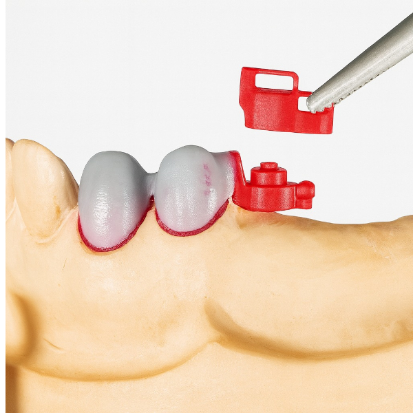 OT Unilateral Attachment Kit - Rhein83 - Vijai Dental