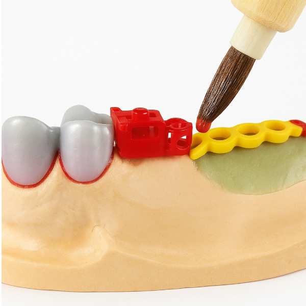 OT Unilateral Attachment Kit - Rhein83 - Vijai Dental